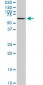 MAK Antibody (monoclonal) (M01)